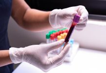 Magas RDW-CV a vérképben: Mit jelent pontosan? Magas RDW-CV